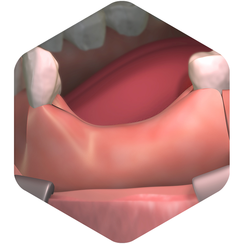 3D illustration of gums without teeth.